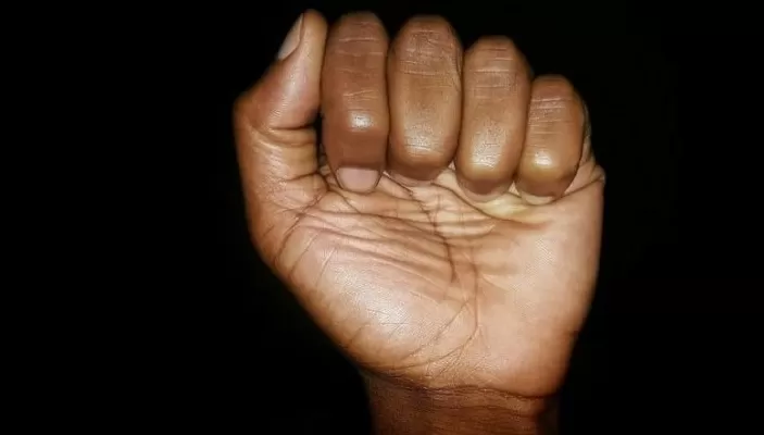 Foto: Divulgação / Internet 