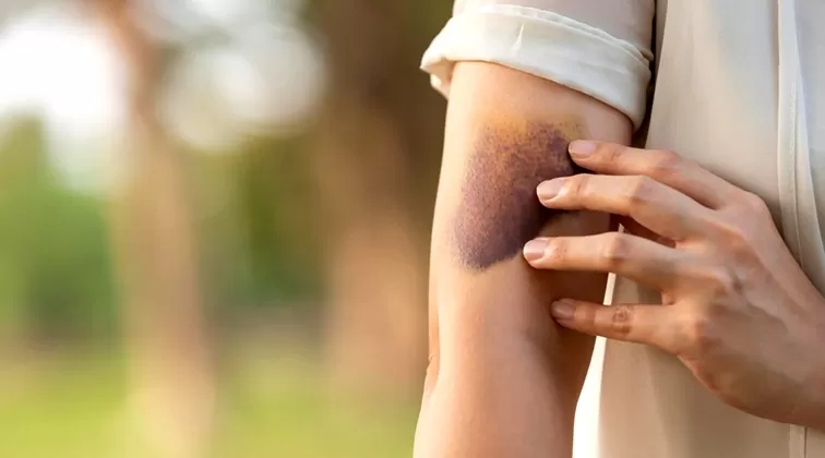 Casos de Leucemia no Brasil disparam em 10 anos e superam crescimento populacional