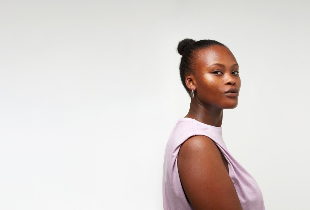 A acne é mais comum em adolescentes e jovens - Foto: Divulgação