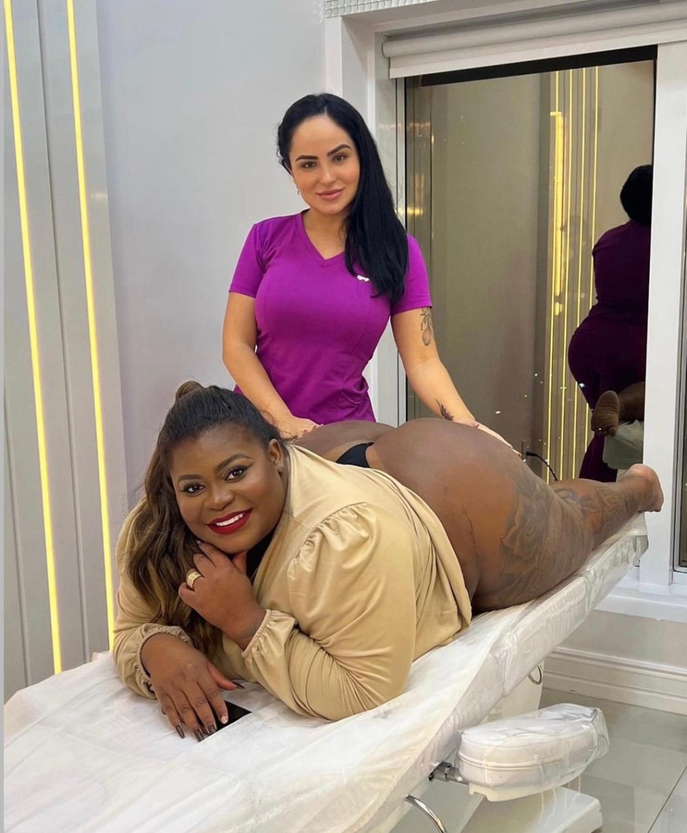 O Round Glúteo é uma injeção de bioativos na região dos glúteos que dá forma e tamanho para o bumbum - Foto: Divulgação 