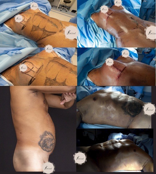 Confira o antes e o depois do casal - Foto: Divulgação JK / Estética Avançada 